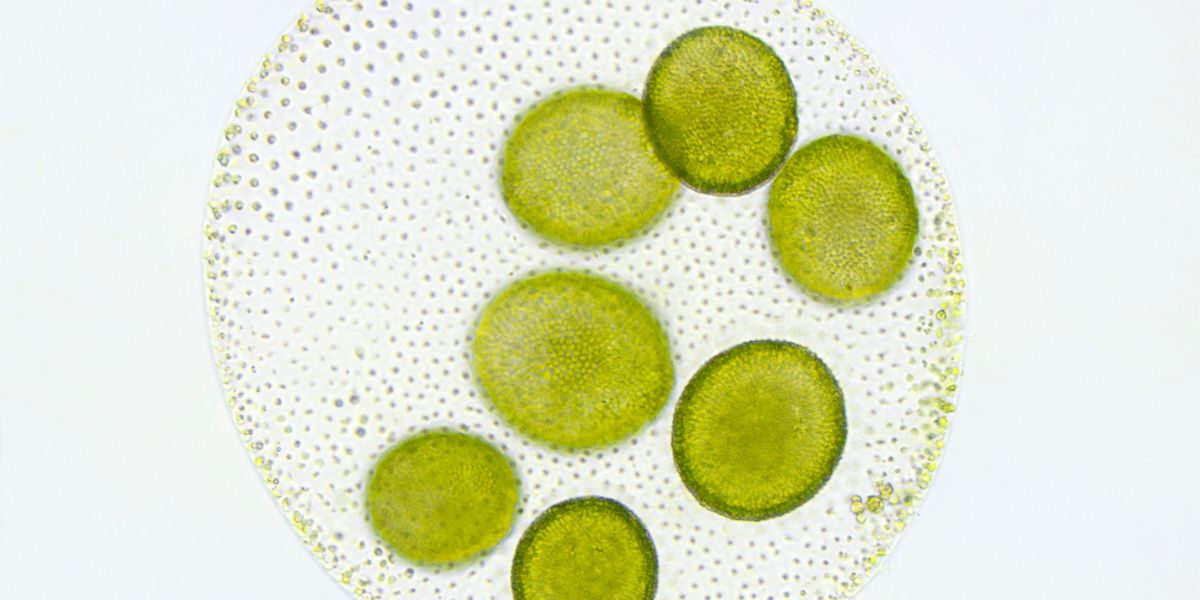 Algae microscope image 
