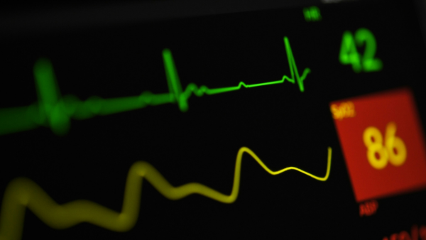 Close-up of a hospital patient monitor displaying heart rate and vital sign waveforms, with readings of 42 and 86 highlighted on a dark screen